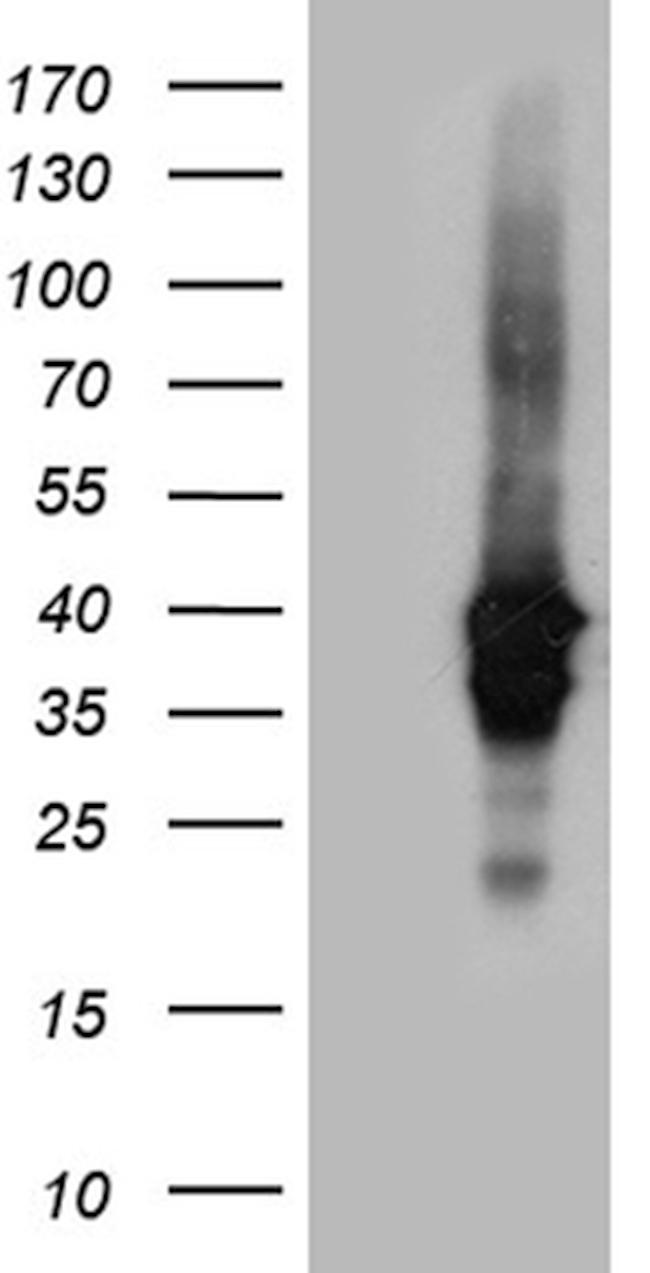 UPRT Antibody in Western Blot (WB)