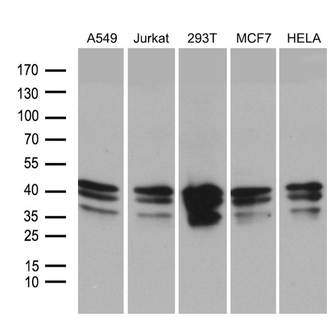 UPRT Antibody in Western Blot (WB)