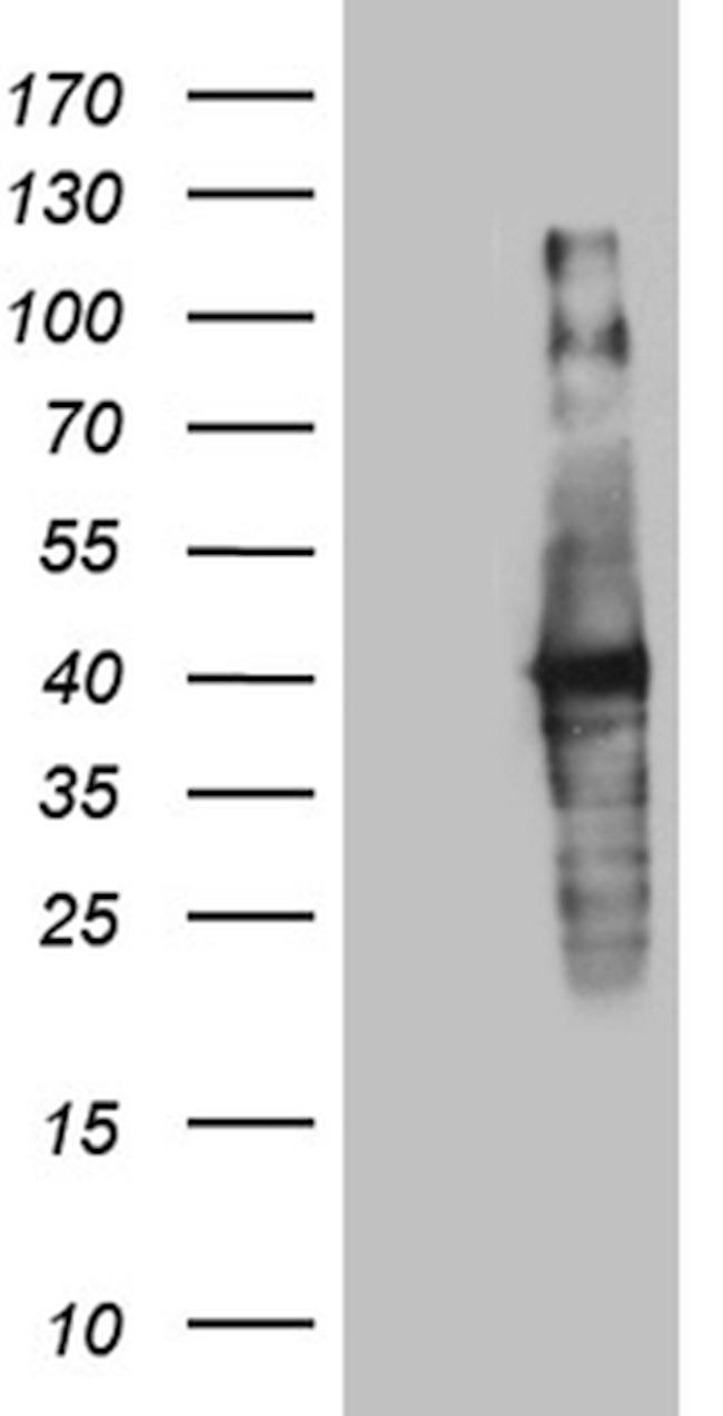 UPRT Antibody in Western Blot (WB)