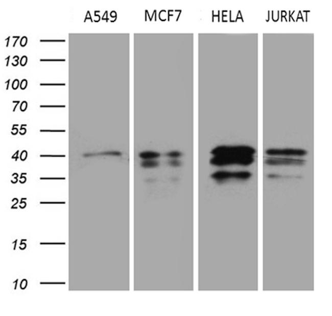 UPRT Antibody in Western Blot (WB)