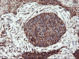 UQCRC1 Antibody in Immunohistochemistry (Paraffin) (IHC (P))