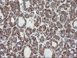 UQCRC1 Antibody in Immunohistochemistry (Paraffin) (IHC (P))