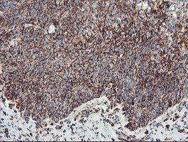 UQCRC1 Antibody in Immunohistochemistry (Paraffin) (IHC (P))