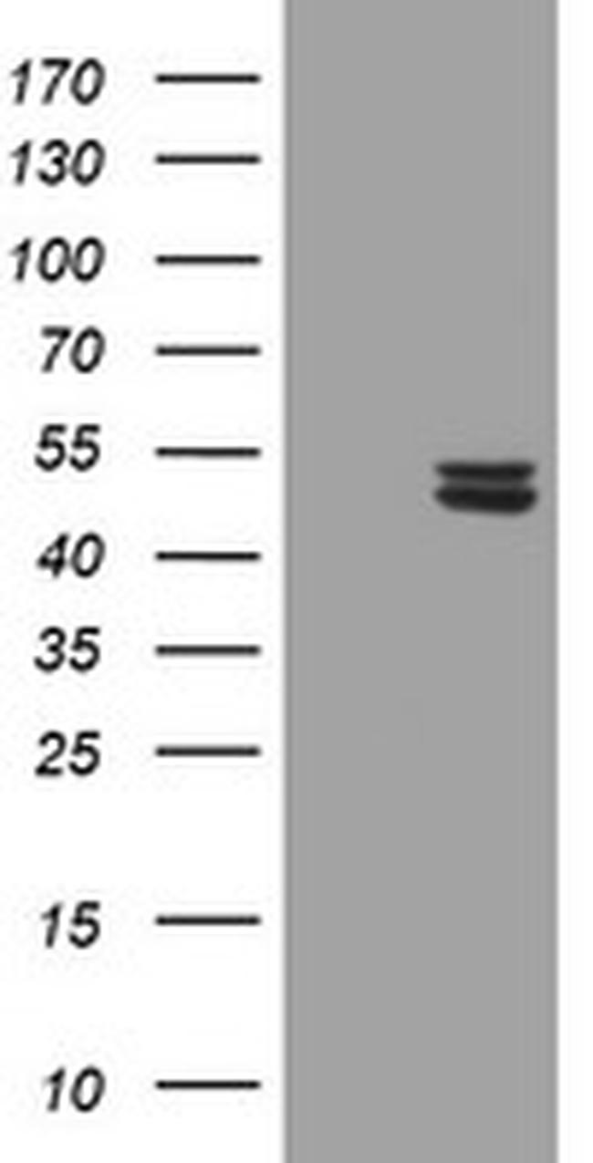 UQCRC1 Antibody in Western Blot (WB)