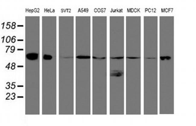 UQCRC1 Antibody in Western Blot (WB)