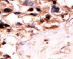 UCKL1 Antibody in Immunohistochemistry (IHC)