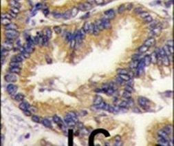 URM1 Antibody in Immunohistochemistry (IHC)