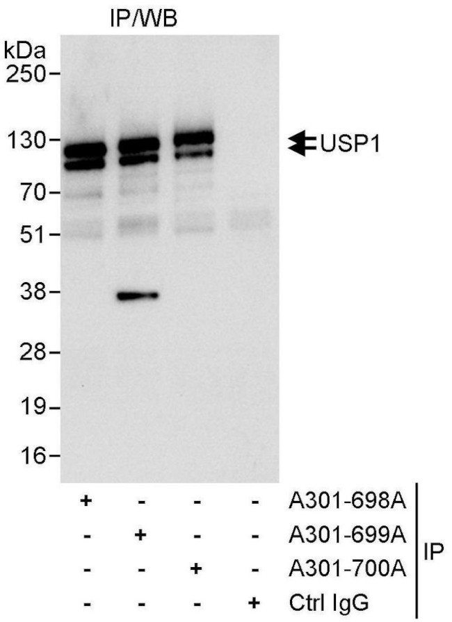 USP1 Antibody in Immunoprecipitation (IP)