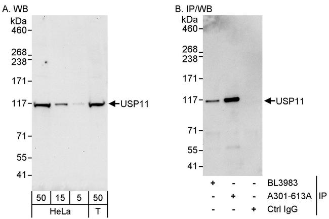 USP11 Antibody in Western Blot (WB)