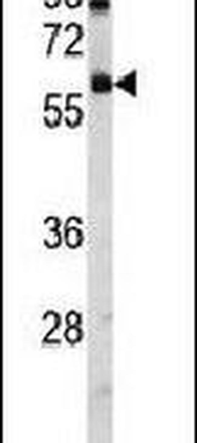 USP14 Antibody in Western Blot (WB)