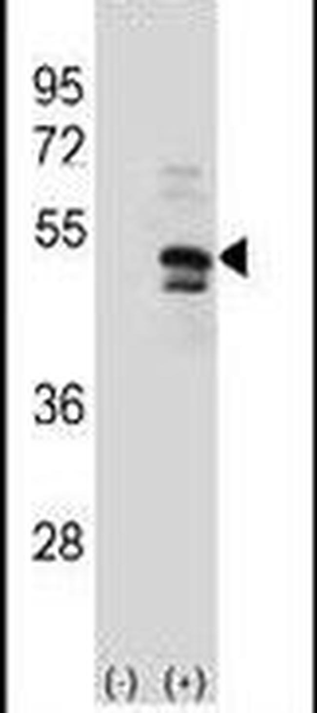 USP14 Antibody in Western Blot (WB)