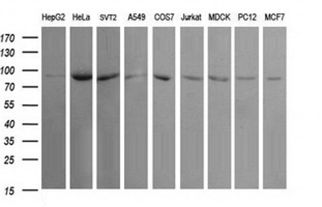 USP16 Antibody in Western Blot (WB)