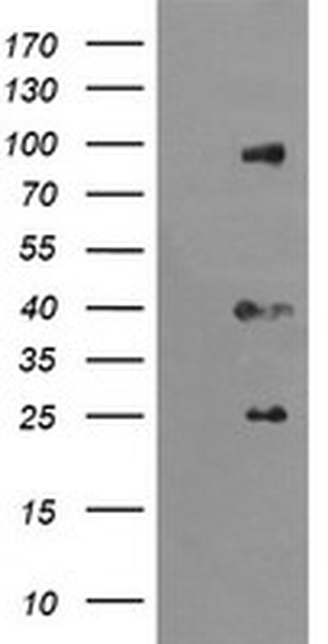 USP16 Antibody in Western Blot (WB)