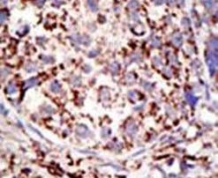 USP3 Antibody in Immunohistochemistry (IHC)