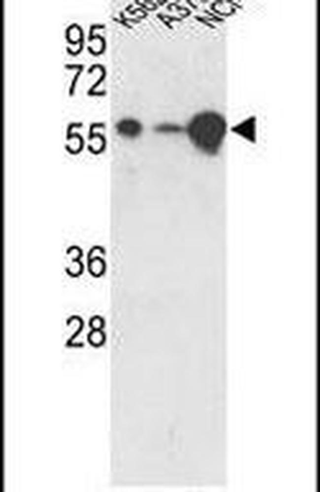 USP3 Antibody in Western Blot (WB)