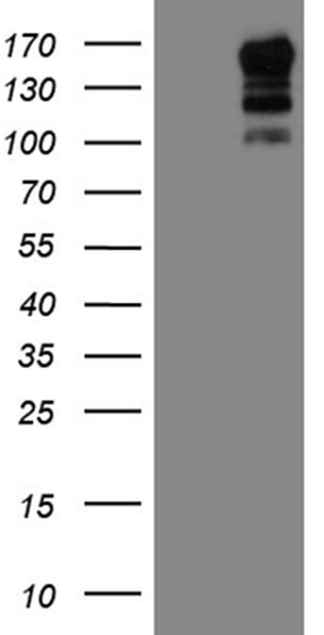 USP40 Antibody in Western Blot (WB)