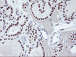 USP7 Antibody in Immunohistochemistry (Paraffin) (IHC (P))