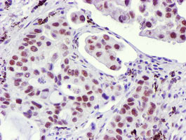 USP7 Antibody in Immunohistochemistry (Paraffin) (IHC (P))