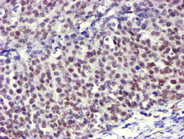 USP7 Antibody in Immunohistochemistry (Paraffin) (IHC (P))