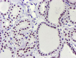 USP7 Antibody in Immunohistochemistry (Paraffin) (IHC (P))