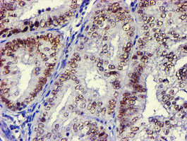 USP7 Antibody in Immunohistochemistry (Paraffin) (IHC (P))