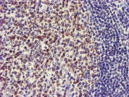 USP7 Antibody in Immunohistochemistry (Paraffin) (IHC (P))