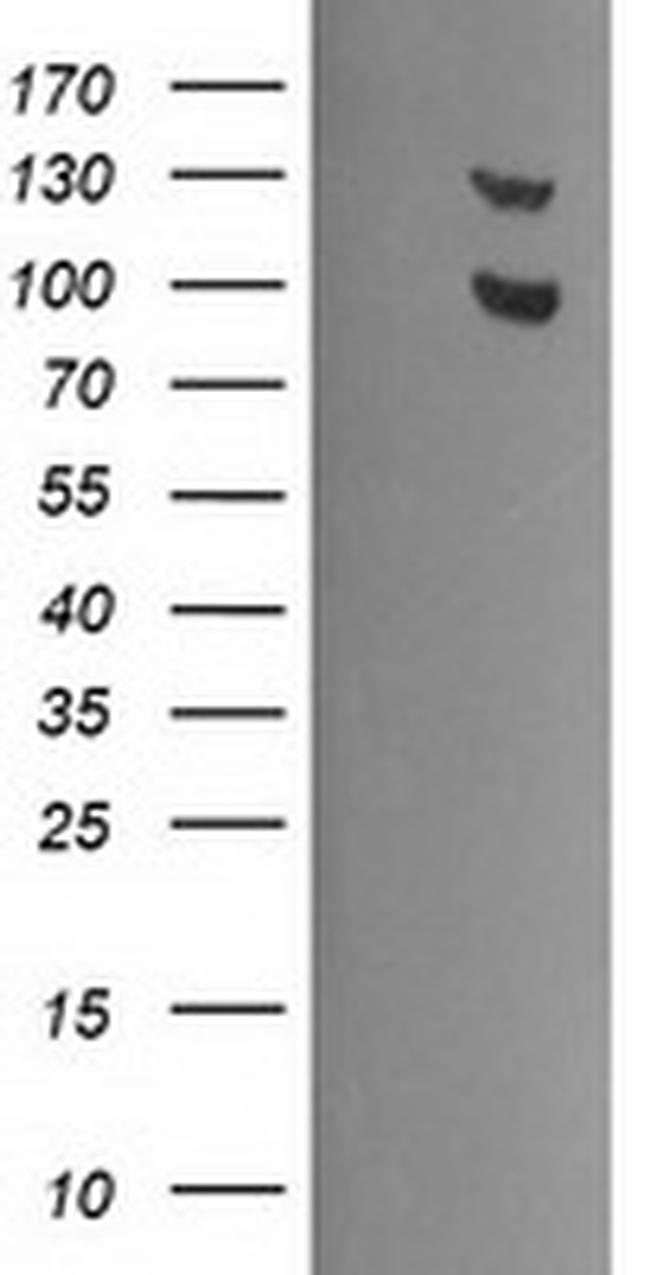 USP7 Antibody in Western Blot (WB)