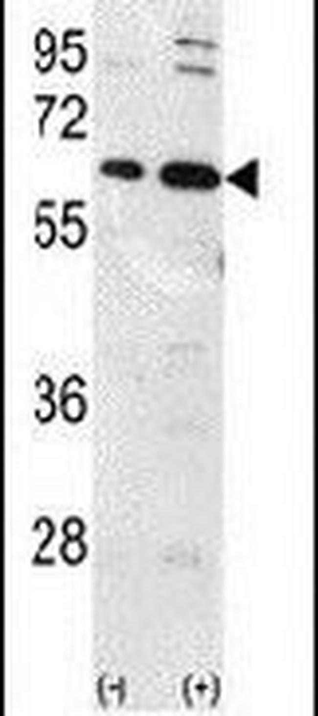 Ubiquilin 1 Antibody in Western Blot (WB)