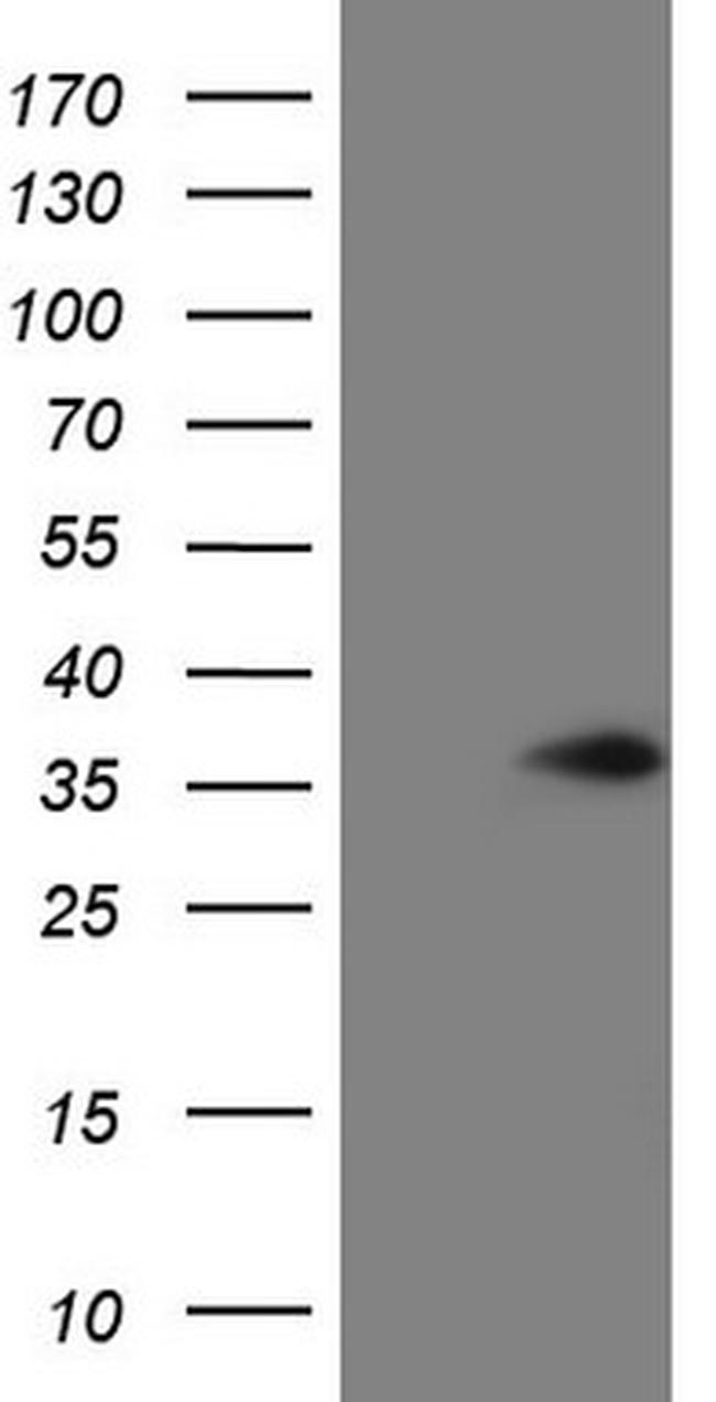 VAPB Antibody in Western Blot (WB)