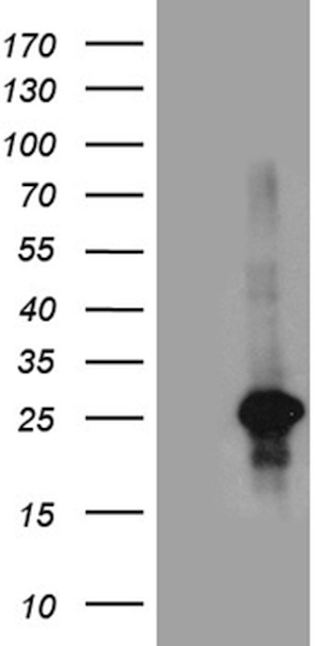 VAX1 Antibody in Western Blot (WB)