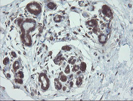 VBP1 Antibody in Immunohistochemistry (Paraffin) (IHC (P))