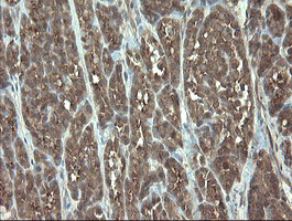 VBP1 Antibody in Immunohistochemistry (Paraffin) (IHC (P))