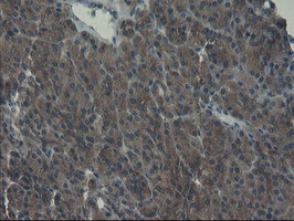 VBP1 Antibody in Immunohistochemistry (Paraffin) (IHC (P))