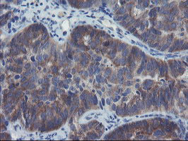 VBP1 Antibody in Immunohistochemistry (Paraffin) (IHC (P))