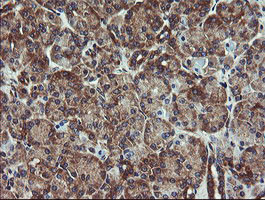 VBP1 Antibody in Immunohistochemistry (Paraffin) (IHC (P))