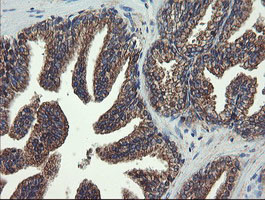 VBP1 Antibody in Immunohistochemistry (Paraffin) (IHC (P))