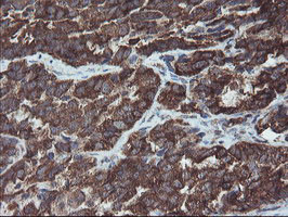 VBP1 Antibody in Immunohistochemistry (Paraffin) (IHC (P))