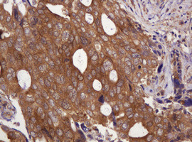 VBP1 Antibody in Immunohistochemistry (Paraffin) (IHC (P))