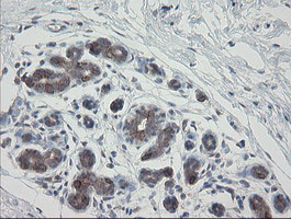 VBP1 Antibody in Immunohistochemistry (Paraffin) (IHC (P))