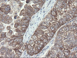 VBP1 Antibody in Immunohistochemistry (Paraffin) (IHC (P))