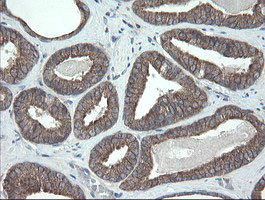 VBP1 Antibody in Immunohistochemistry (Paraffin) (IHC (P))