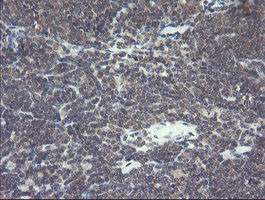 VBP1 Antibody in Immunohistochemistry (Paraffin) (IHC (P))