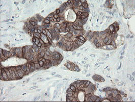 VBP1 Antibody in Immunohistochemistry (Paraffin) (IHC (P))