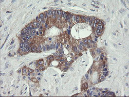 VBP1 Antibody in Immunohistochemistry (Paraffin) (IHC (P))