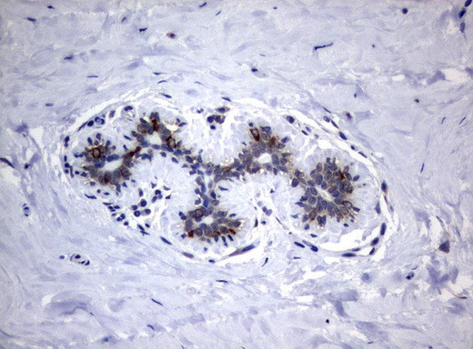 VBP1 Antibody in Immunohistochemistry (Paraffin) (IHC (P))