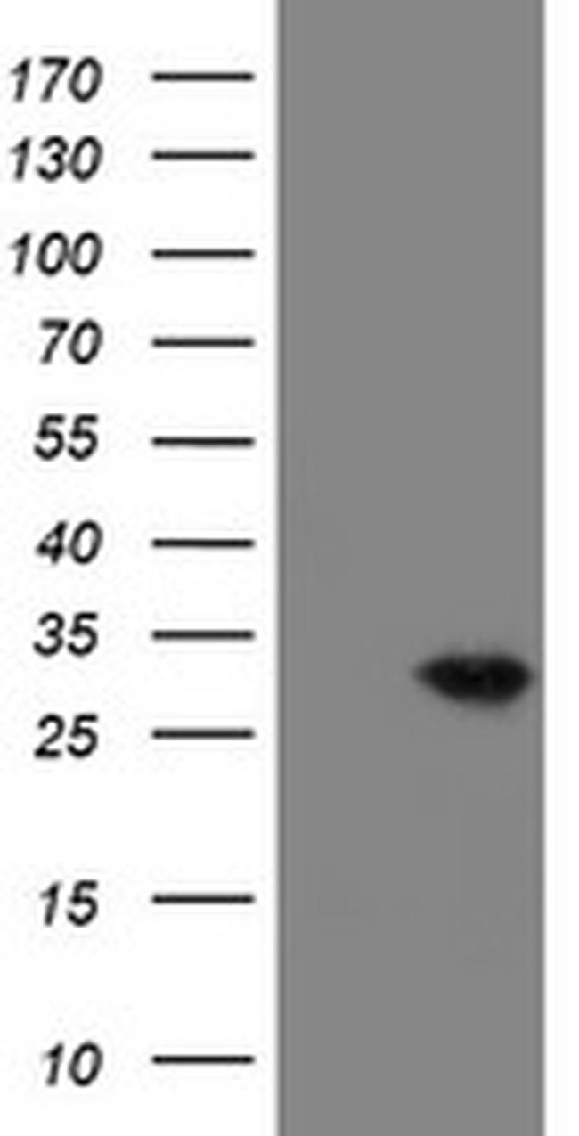 VBP1 Antibody in Western Blot (WB)