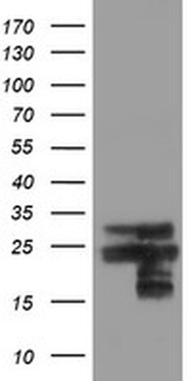 VBP1 Antibody in Western Blot (WB)