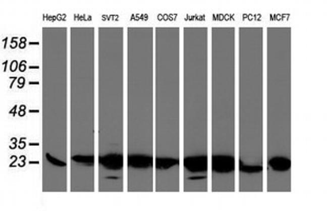 VBP1 Antibody in Western Blot (WB)