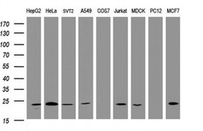 VBP1 Antibody in Western Blot (WB)