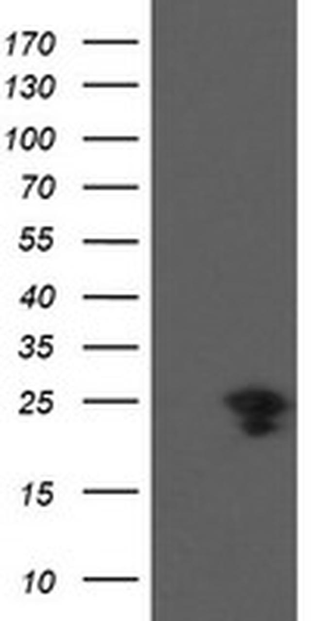 VBP1 Antibody in Western Blot (WB)